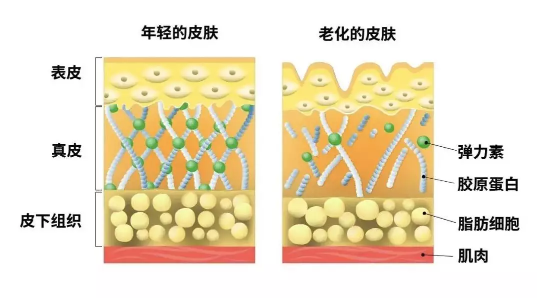 抗衰这件事，几岁做适合？